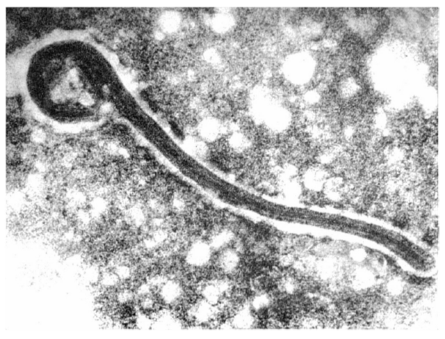 Understanding Marburg Virus: Structure, Transmission, and Vaccine Development