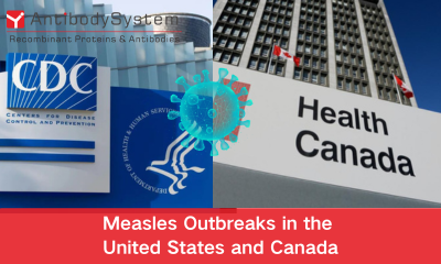 Measles Outbreaks in the United States and Canada