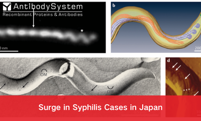 Surge in Syphilis Cases in Japan