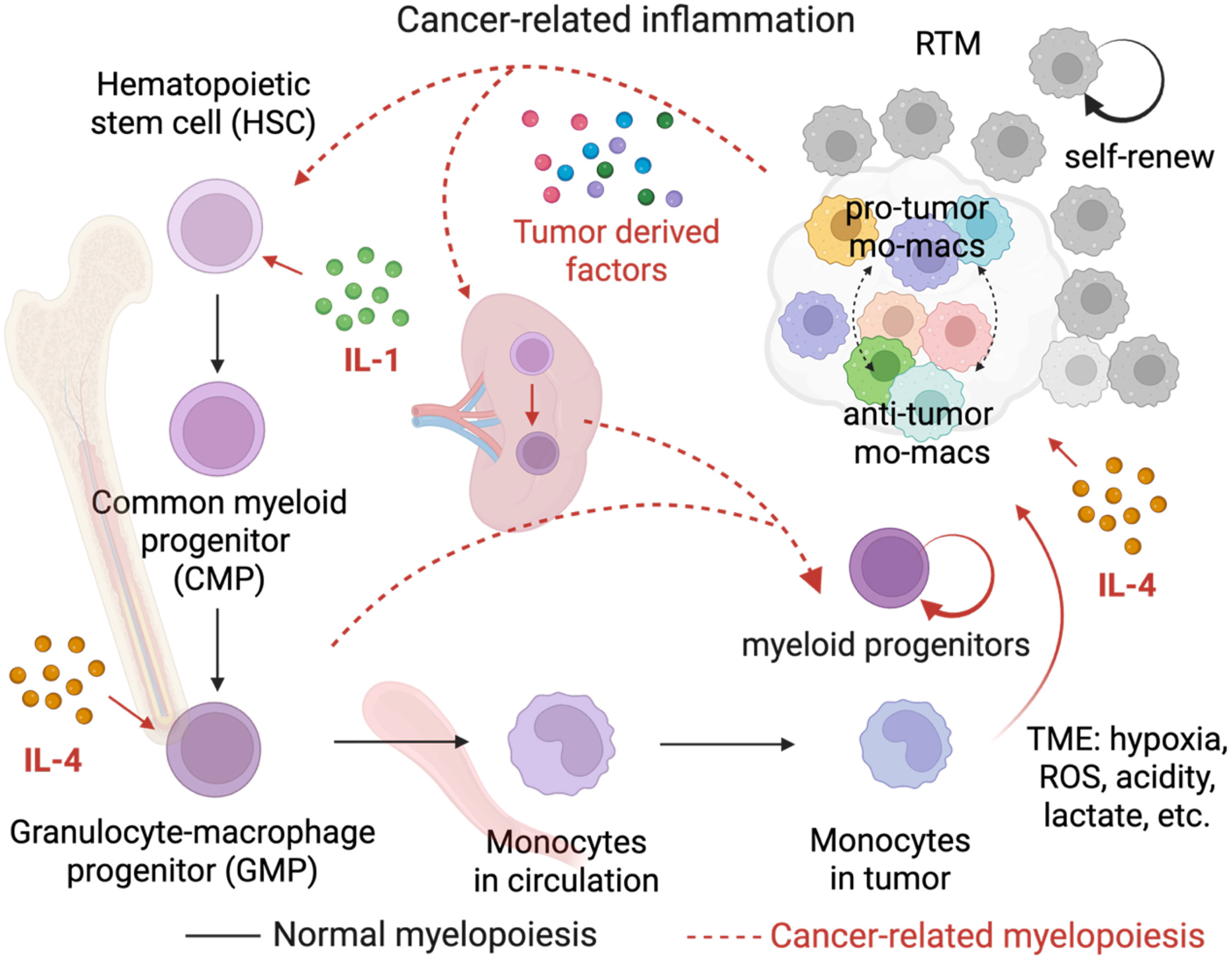 Tumors shape macrophages