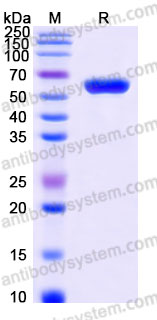 Recombinant Human TNFRSF11B Protein, C-His (Active)