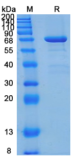 Recombinant Human EPHB6 Protein, C-10*His (Active)
