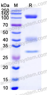 Recombinant Human Laminin 521 E8 Protein, N-His & N-Flag & N-HA (Active)