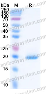 Recombinant Human FGF10 Protein, Tag free (Active)