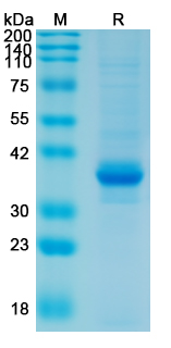 Recombinant Human CD335/NCR1/NKp46 Protein, C-His (Active)