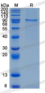 Recombinant Human NTN1/Netrin-1 Protein, C-His (Active)
