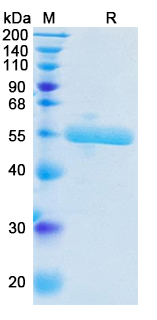 Recombinant Human PLAU Protein, C-His (Active)