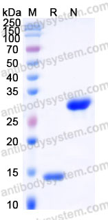 Recombinant Human PDGFB Protein, Tag free (Active)