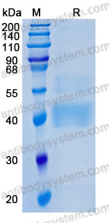 Recombinant Human TGFB1/TGF-beta-1 Protein, N-
8*His (Active)