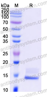 Biotinylated Human TGFB1/TGF-beta-1 Protein, N-Avi (Active)