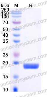 Recombinant Human TNFa/TNF-alpha Protein, N-His (Active)
