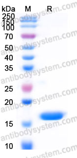 Recombinant Human TNFa/TNF-alpha Protein, C-His (Active)