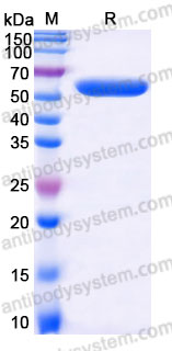 Recombinant Human IFNB1/IFN-beta Protein, N-Fc (Active)