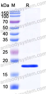 Recombinant Human IL1B/IL1F2 Protein, Tag free (Active)
