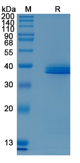Recombinant Human APOE Protein, C-His (Active)