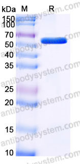 Recombinant Human FN1/Fibronectin Protein, Tag free (Active)