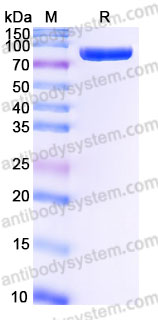 Biotinylated Human CD71/TFRC Protein, N-His-Avi