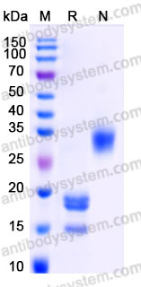Recombinant Human PDGF-AB Protein, Tag free (Active)