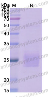 Biotinylated Human CSF2/GM-CSF Protein, C-Avi-His