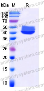 Recombinant Human IL4 Protein, C-Fc (Active)