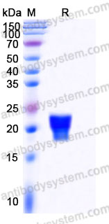Recombinant Human IL5 Protein, C-His (Active)