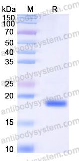Recombinant Human IL6/Interleukin-6 Protein, Tag free (Active)