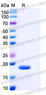 Recombinant Human FGF2/FGFb Protein, Tag free (Active)