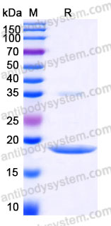 Recombinant Human FGF2/FGFb Protein, Tag free (Active)