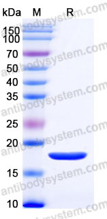 Recombinant Human CSF3/G-CSF Protein, Tag free (Active)