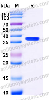 Recombinant Human GZMB Protein, C-His (Active)