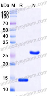 Recombinant Human TGFB3/TGF-beta-3 Protein, Tag free (Active)