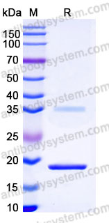 Recombinant Human IL7 Protein, Tag free (Active)