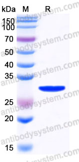 Recombinant Human OSM/Oncostatin-M Protein, N-His (Active)