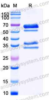 Recombinant Human HGF Protein, C-His (Active)