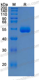 Recombinant Human CPM Protein, C-His (Active)