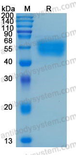 Recombinant Human CD121a/IL1R1 Protein, C-His (Active)