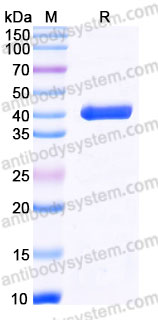 Biotinylated Human CD122/IL2RB Protein, C-His-Avi