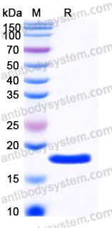 Recombinant Human LIF Protein, Tag free (Active)