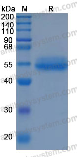 Recombinant Human B4GALT1 Protein, N-His (Active)