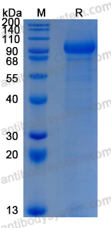 Recombinant Human GLB1 Protein, C-His (Active)