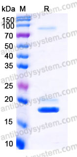 Recombinant Human BMP7 Protein, tag free (Active)