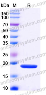 Recombinant Human IL1RN/IL-1ra/IL1F3 Protein, Tag free (Active)