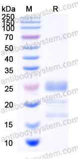 Recombinant Human FGF7 Protein, C-His (Active)