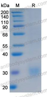 Recombinant Human CBLN1 Protein, N-His (Active)