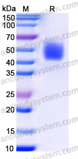 Biotinylated Human CD124/IL4R/IL-4Rα Protein, C-Avi-His