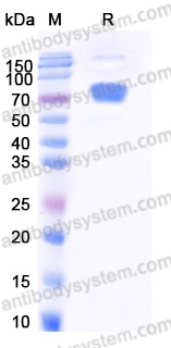 Recombinant Human CD124/IL4R/IL-4R&alpha; Protein, C-mFc (Active)