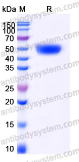 Recombinant Human CD124/IL4R/IL-4R&alpha; Protein, C-His (Active)