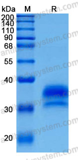 Recombinant Human IGFBP6 Protein, C-His (Active)