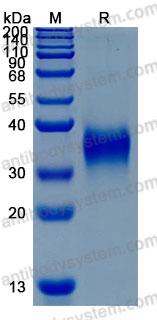 Recombinant Human IGFBP5 Protein, C-His (Active)