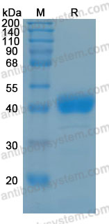 Recombinant Human AZGP1 Protein, C-His (Active)